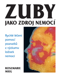 Zuby jako zdroj nemocí